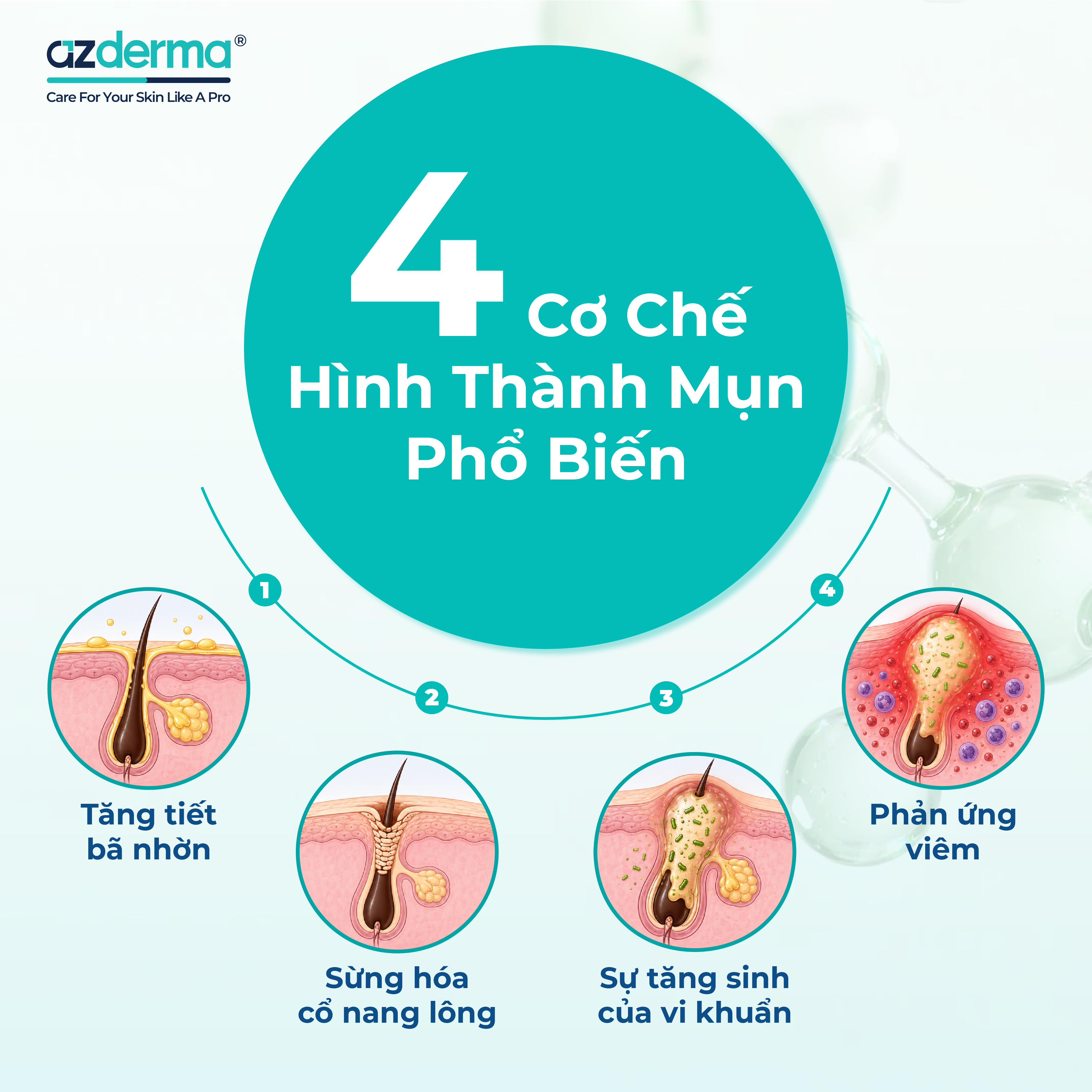 4 cơ chế hình thành mụn viêm trên da